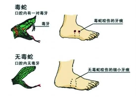 质疑医院延误救治！当地卫健委介入！开元棋牌女子三亚疑被蛇咬身亡家属(图4)